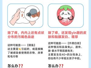 下边痒还一直湿漉漉的？可能是这个原因